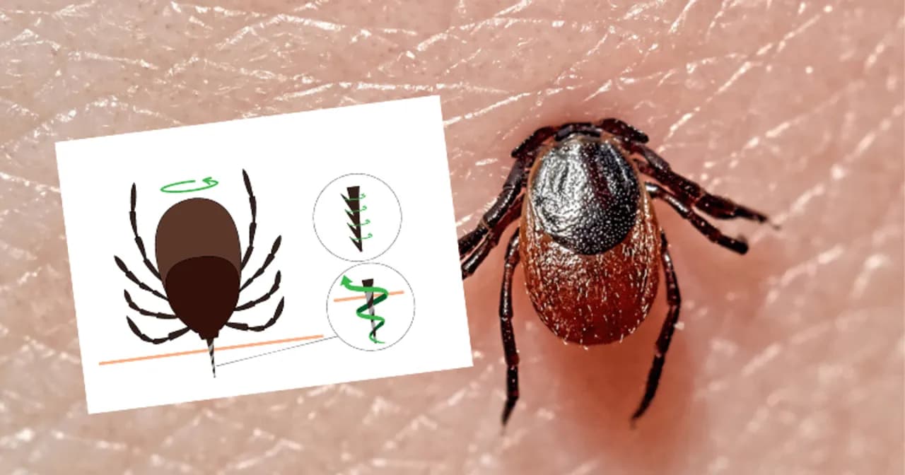 Co zrobić, gdy zostanie głowa kleszcza? Ważne informacje i ryzyko